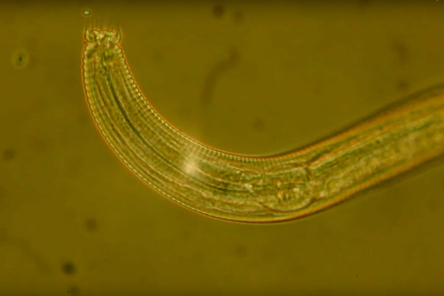 A photo of a nematode worm under the microscope