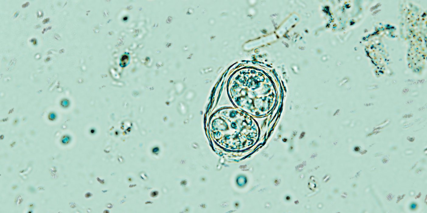 Toxoplasma gondii oocyst under the microscope, isolated.